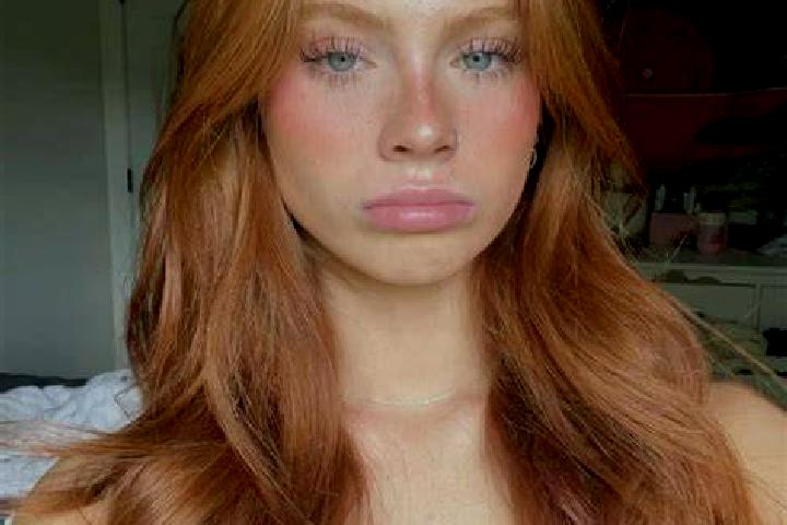 Prednisolone prednisolone eye side effects medication